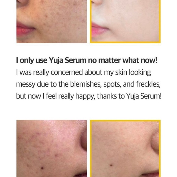 brightening serum - Picture 4 of 6